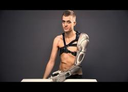 Инженеры создали бионическую руку, которая может расти вместе с человеком